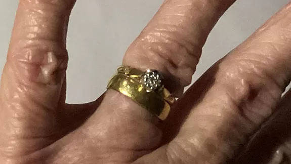 Birchring2